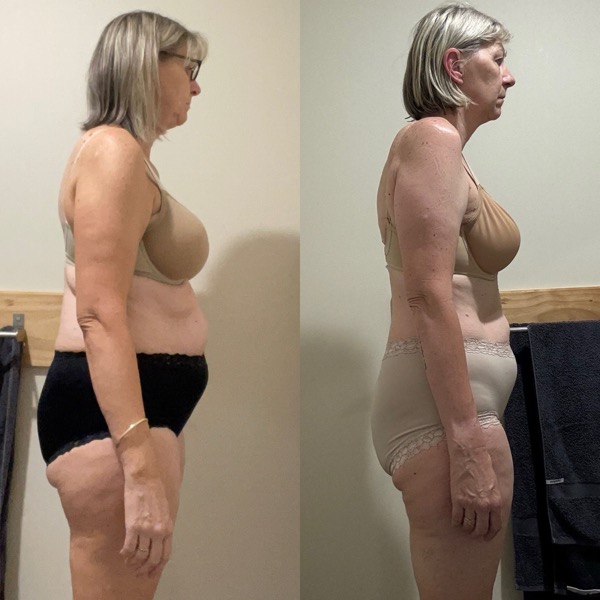 Client transformation